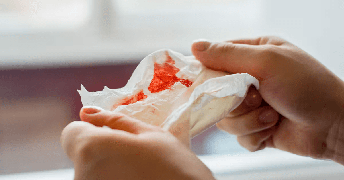 Hemoptysis embolization procedure performed by interventional radiologist in Pakistan